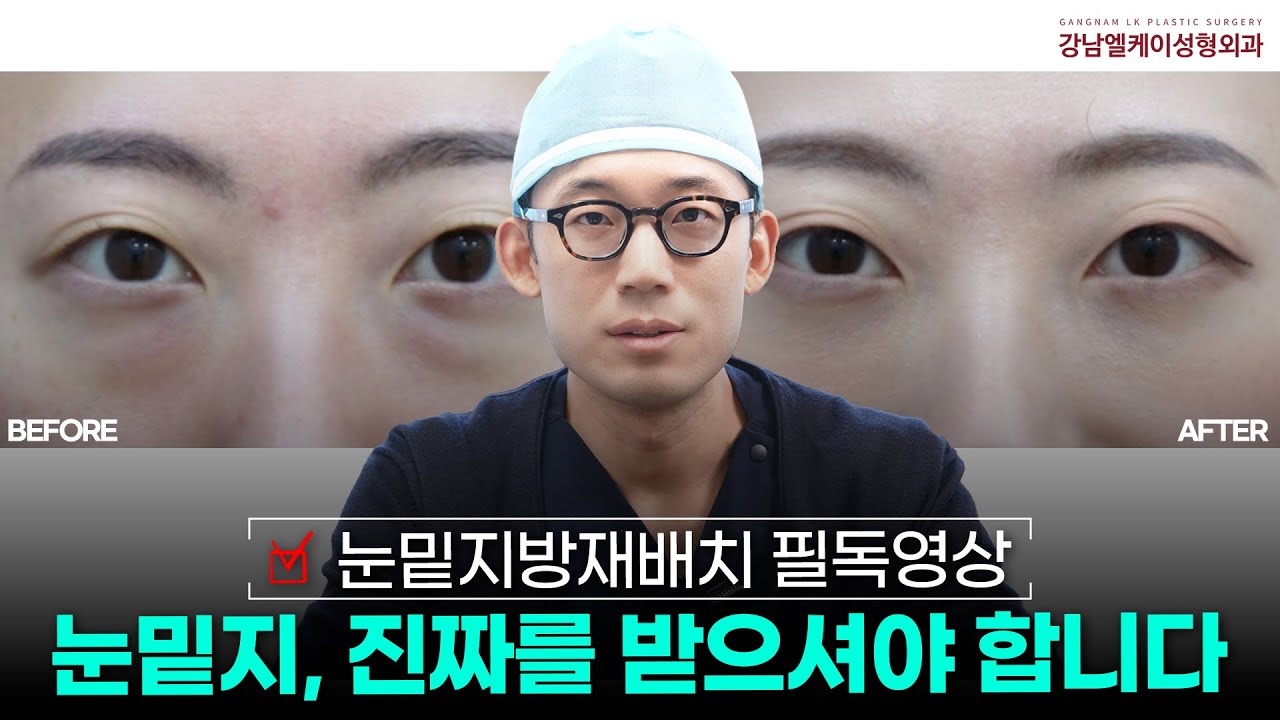 눈밑지방재배치 필독영상ㅣ눈밑지, '진짜'를 받으셔야 합니다 ! 😨