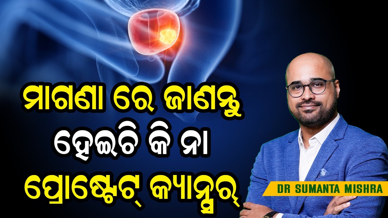 How to Know If You Have Prostate Cancer – Early Signs & Symptoms Explained!