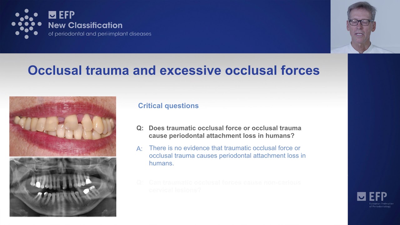 Occlusal trauma and excessive occlusal forces - tutorial by Søren Jepsen