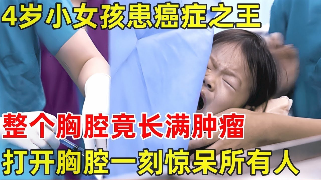 4岁小女孩患癌症之王!整个胸腔长满肿瘤,打开胸腔一刻在场医生震惊了【生命缘】