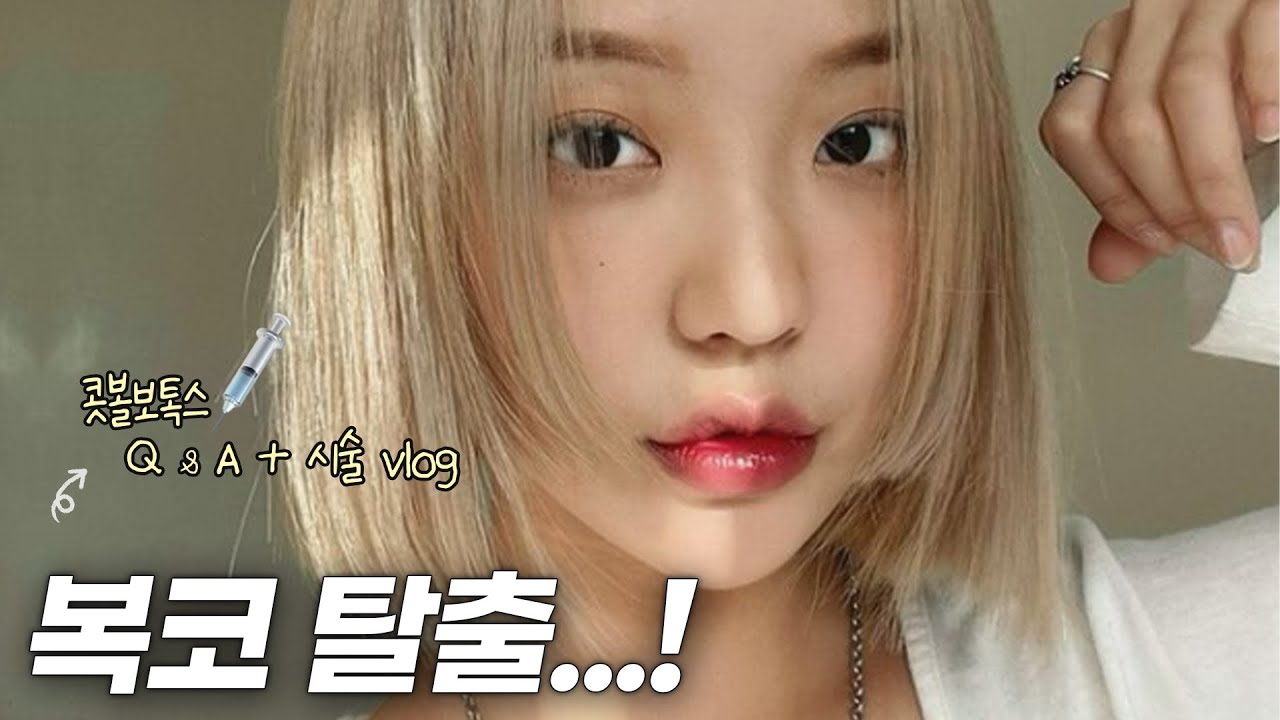 콧볼보톡스 100% 리.얼. 후.기. (병원, 가격, 시술 과정, 부작용, 효과, 붓기) + vlog 💉(with todayommmi)