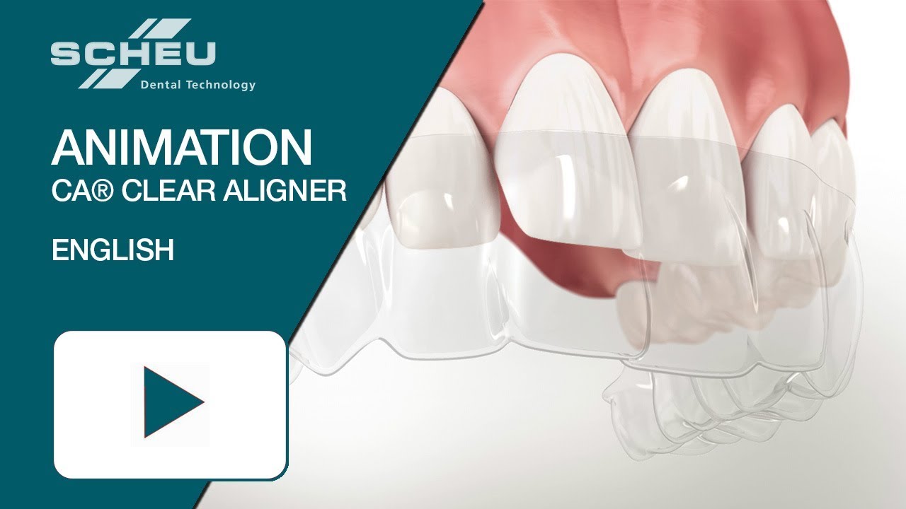 CA® CLEAR ALIGNER Animation (english)
