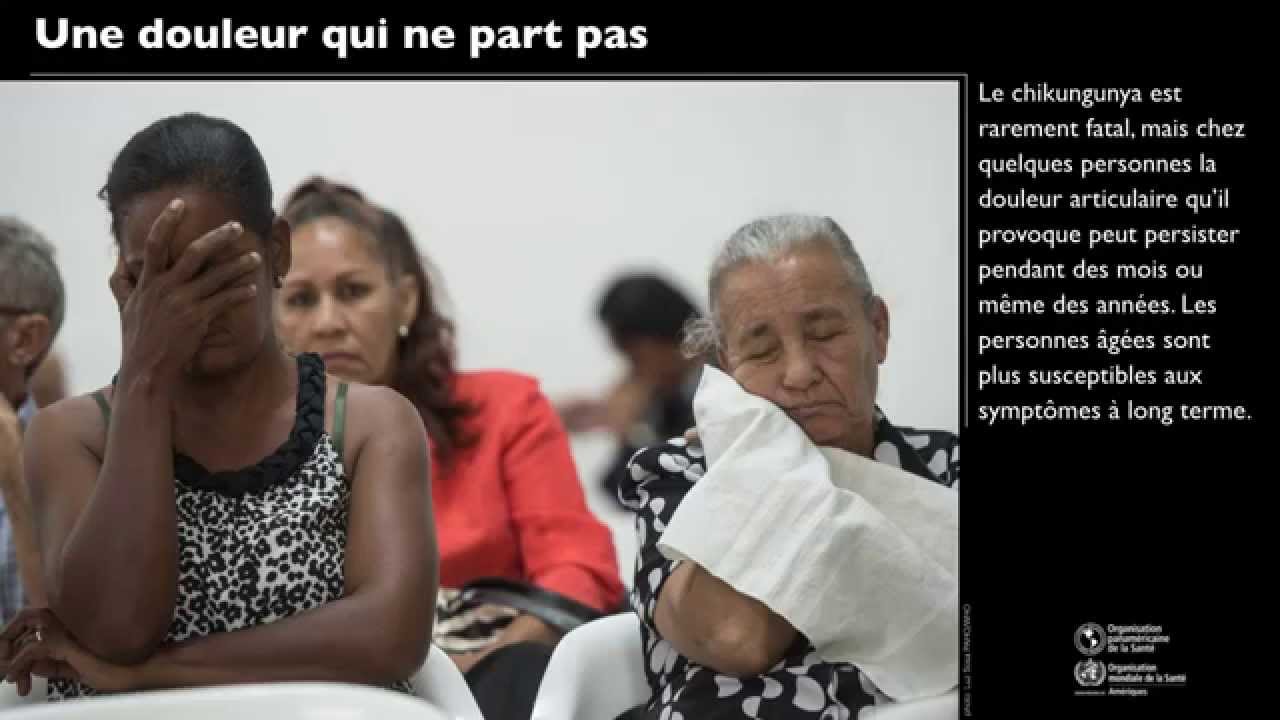 Chikungunya: le virus qui « rend tordu »