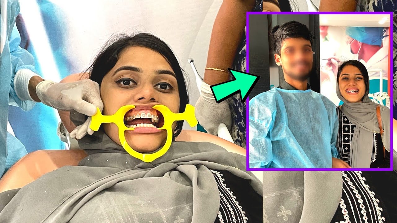 HIBA പല്ലിന് CLIP ഇട്ടു 🤣🤣HIBA യുടെ Doctor BROTHER ആദ്യമായ് വീഡിയോയിൽ🤩BENGUന്റേം Mummyടേം REACTION 🤣