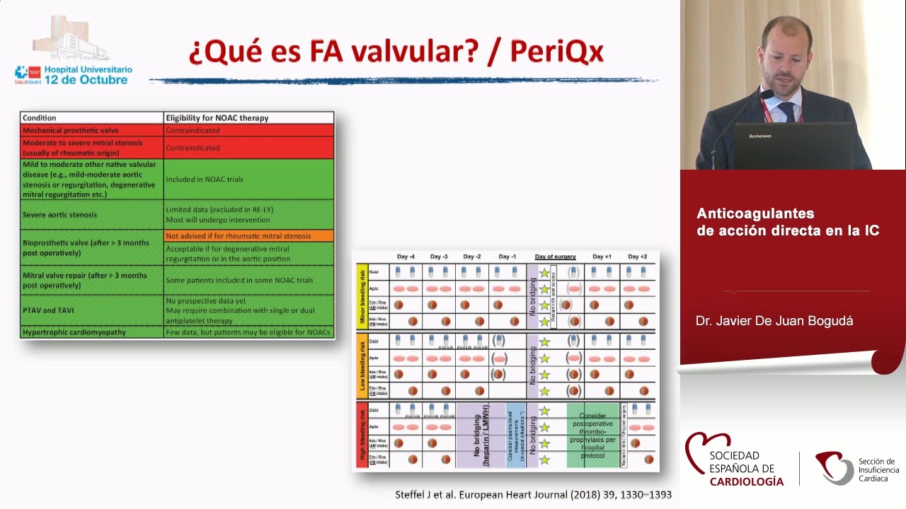 Fibrilación auricular e insuficiencia cardiaca
