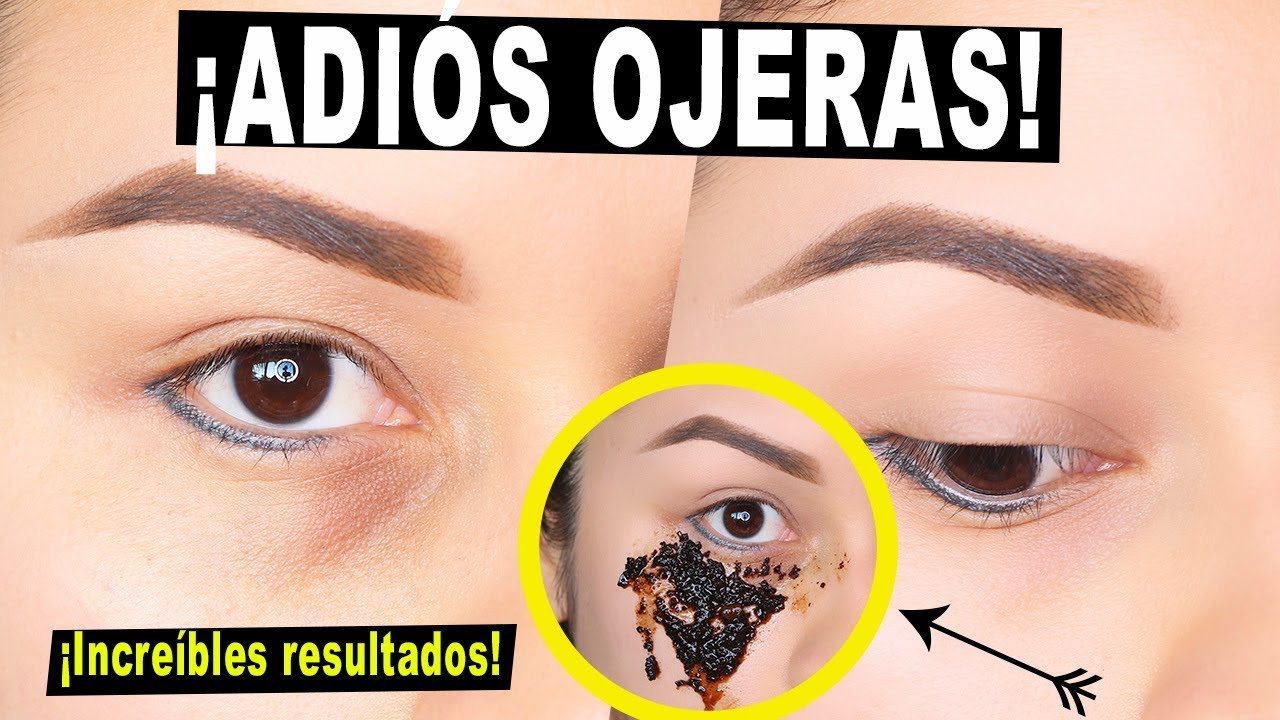 ¡DILE ADIÓS A LAS OJERAS! ¡Resultados Increíbles! 100% NATURAL