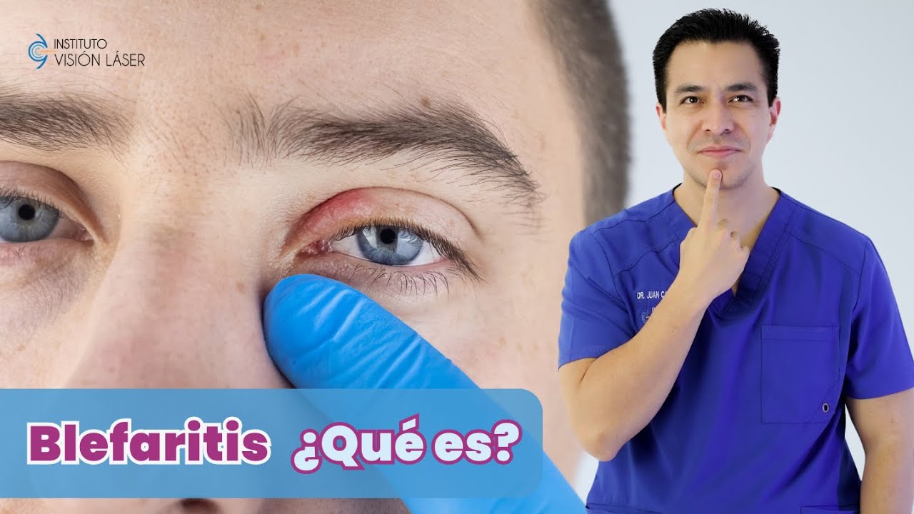 Blefaritis ¿Qué es?