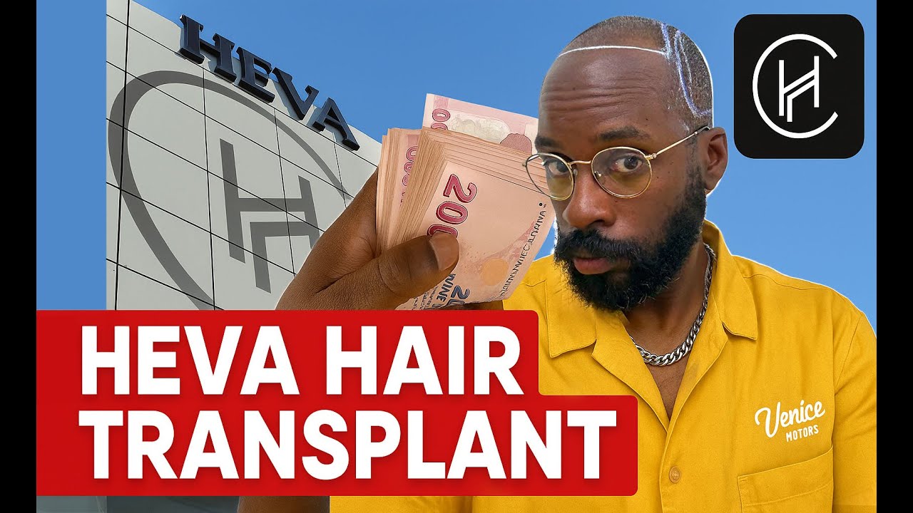 I FINALLY GOT A HAIR TRANSPLANT- HEVA CLINIC- TO ISTANBUL TURKEY