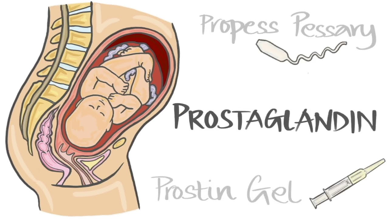Hormonal methods of induction