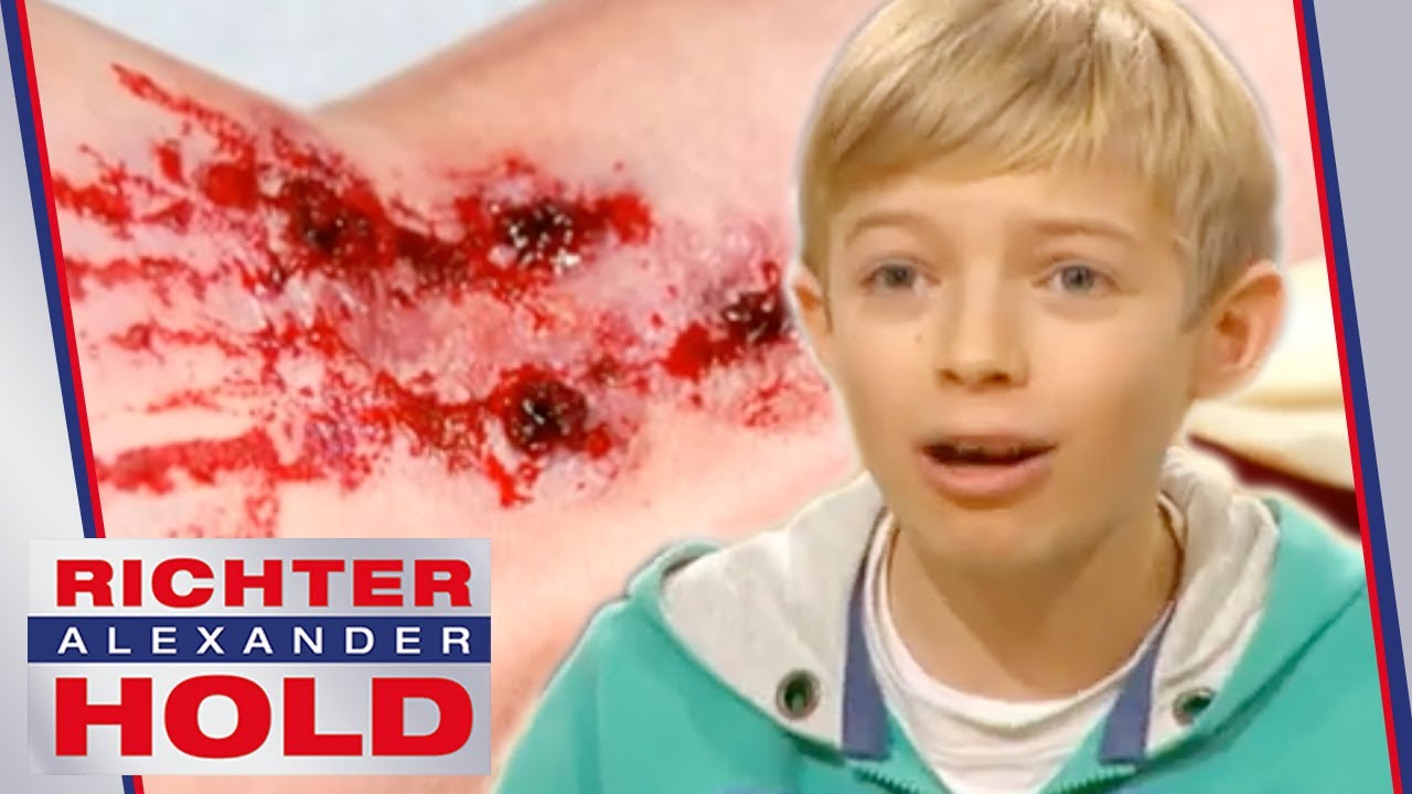 4 N&auml;gel ins Knie geschossen! Kann Jan jemals wieder tanzen? | 1/2 | Richter Alexander Hold | SAT.1
