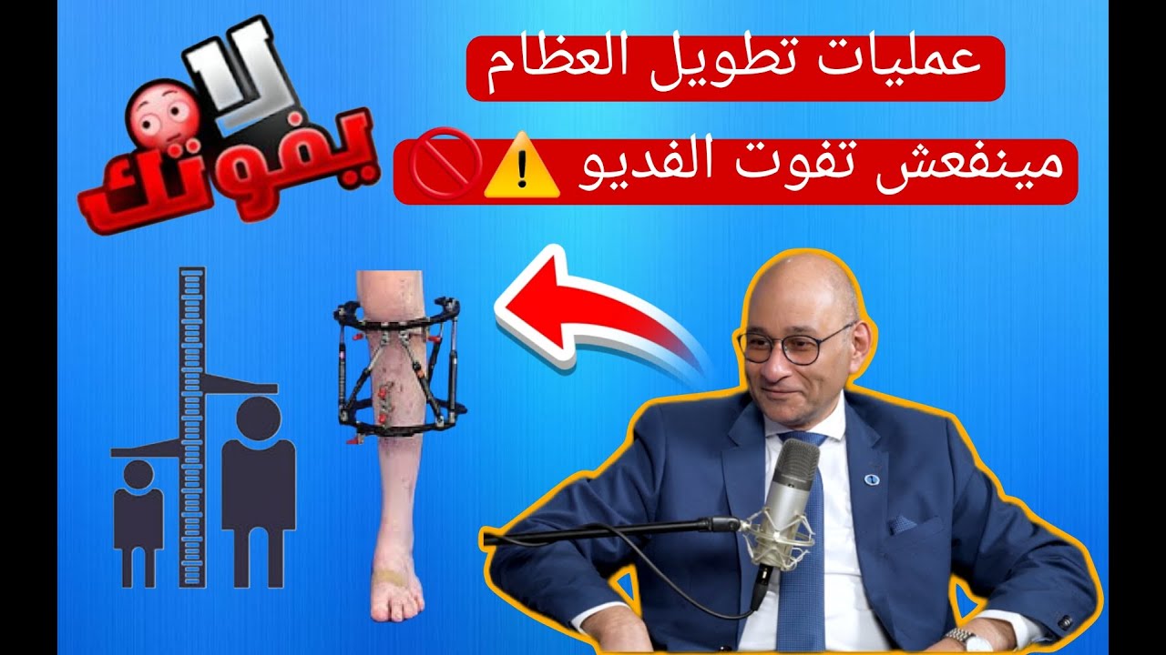 قصر القامة و عملية التطويل التجميلي للعظام مع الدكتور ياسر البطراوي | بودكاست مع البروفيسور