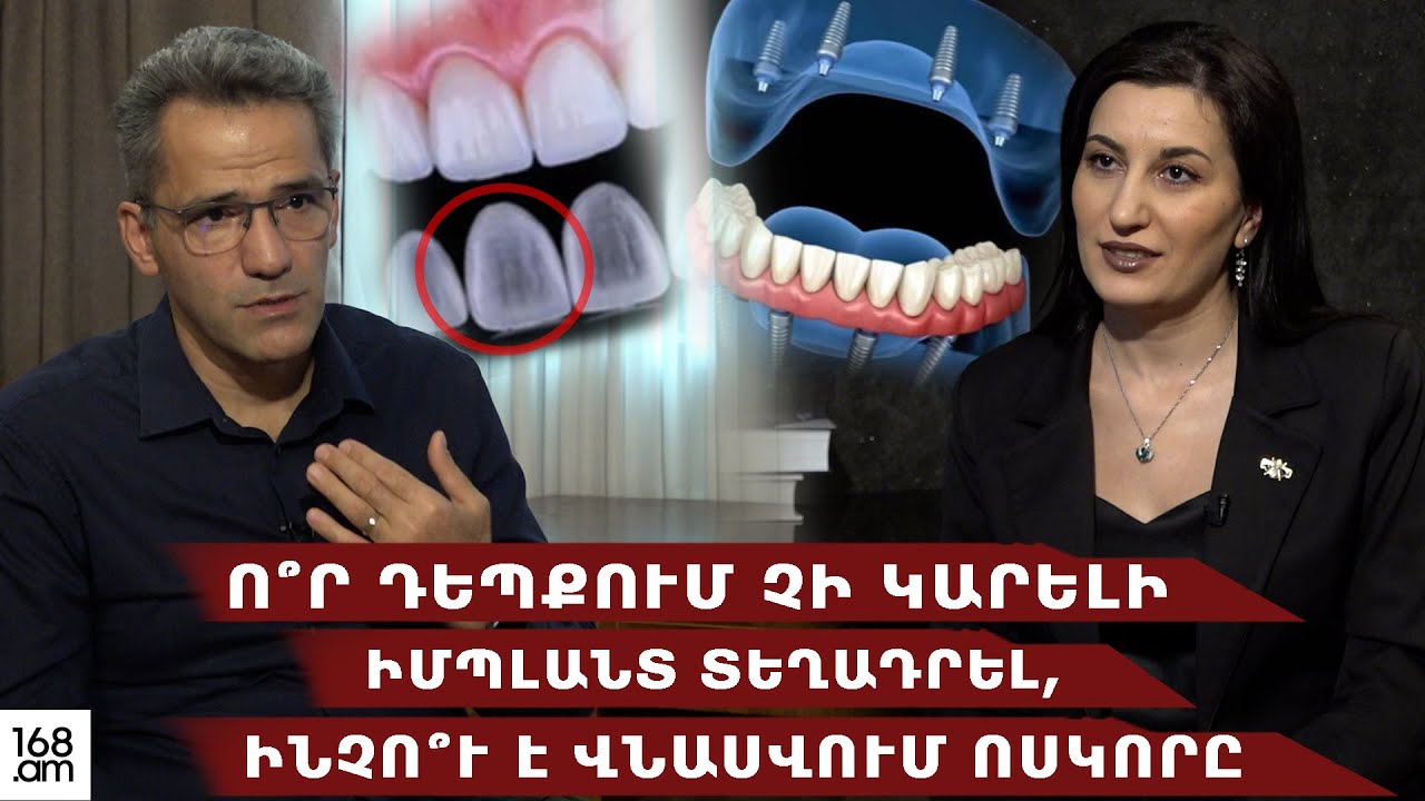Ո՞ր դեպքում ՉԻ ԿԱՐԵԼԻ իմպլանտ տեղադրել, ինչո՞ւ է վնասվում ոսկորը