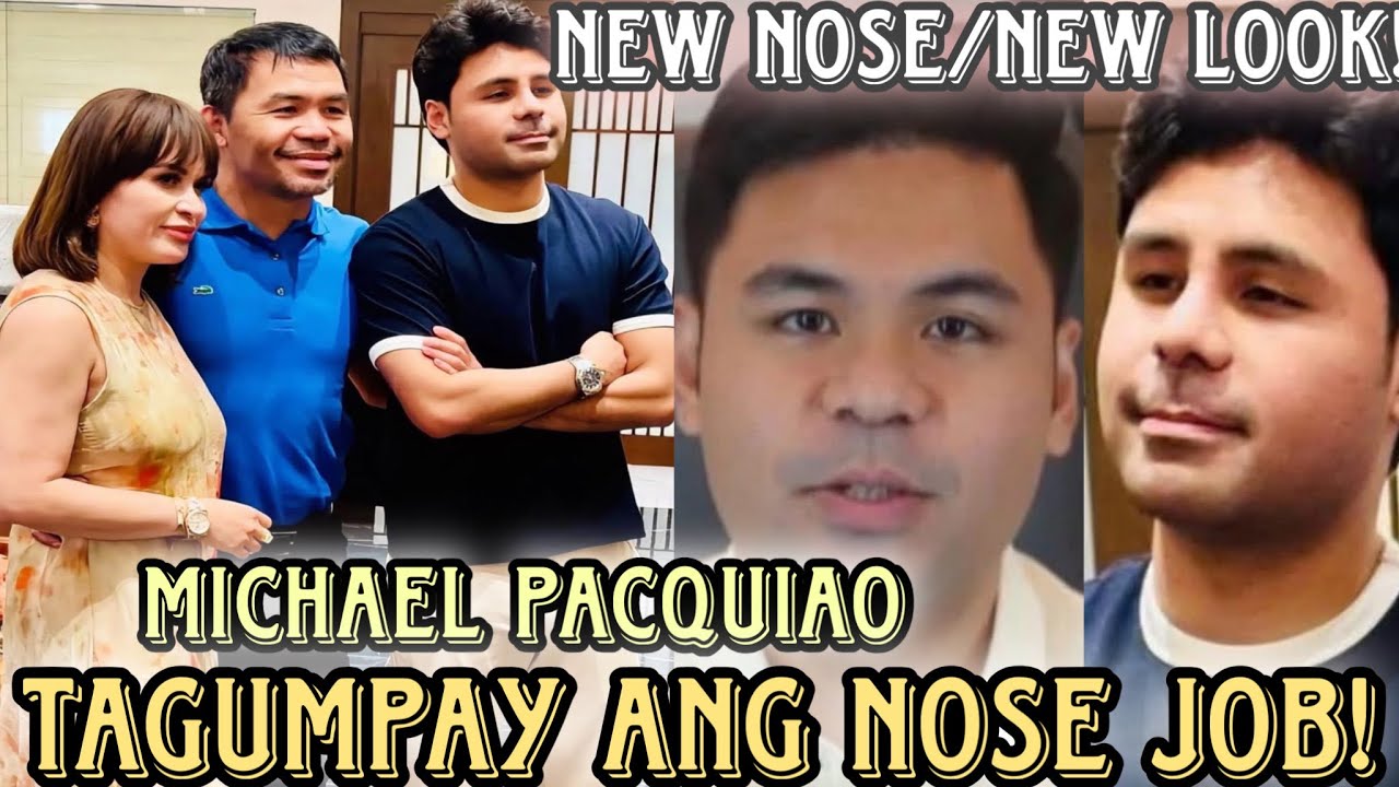 Michael Pacquiao New Nose dahil nagpa Nose Job successful ito masaya ang Mommy Jinkee at Dad Manny❤️