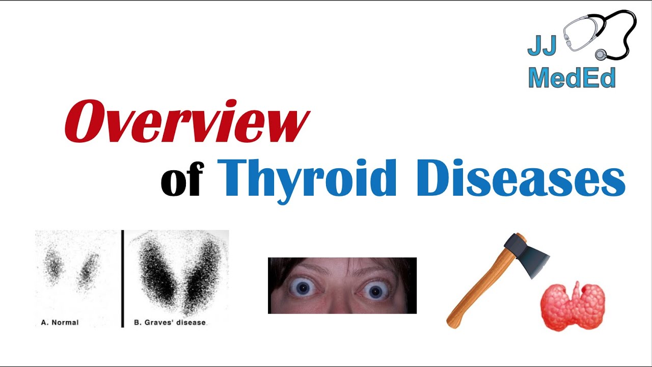 Overview of Thyroid Diseases (Hashimoto&rsquo;s, Graves&rsquo;, Sick Euthyroid Syndrome, Toxic adenoma, etc.)