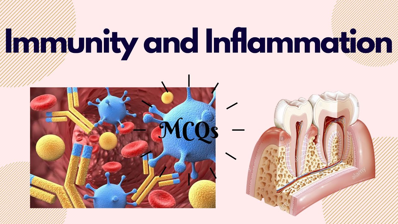 MCQs on Immunity and Inflammation || Periodontics || Dentophile