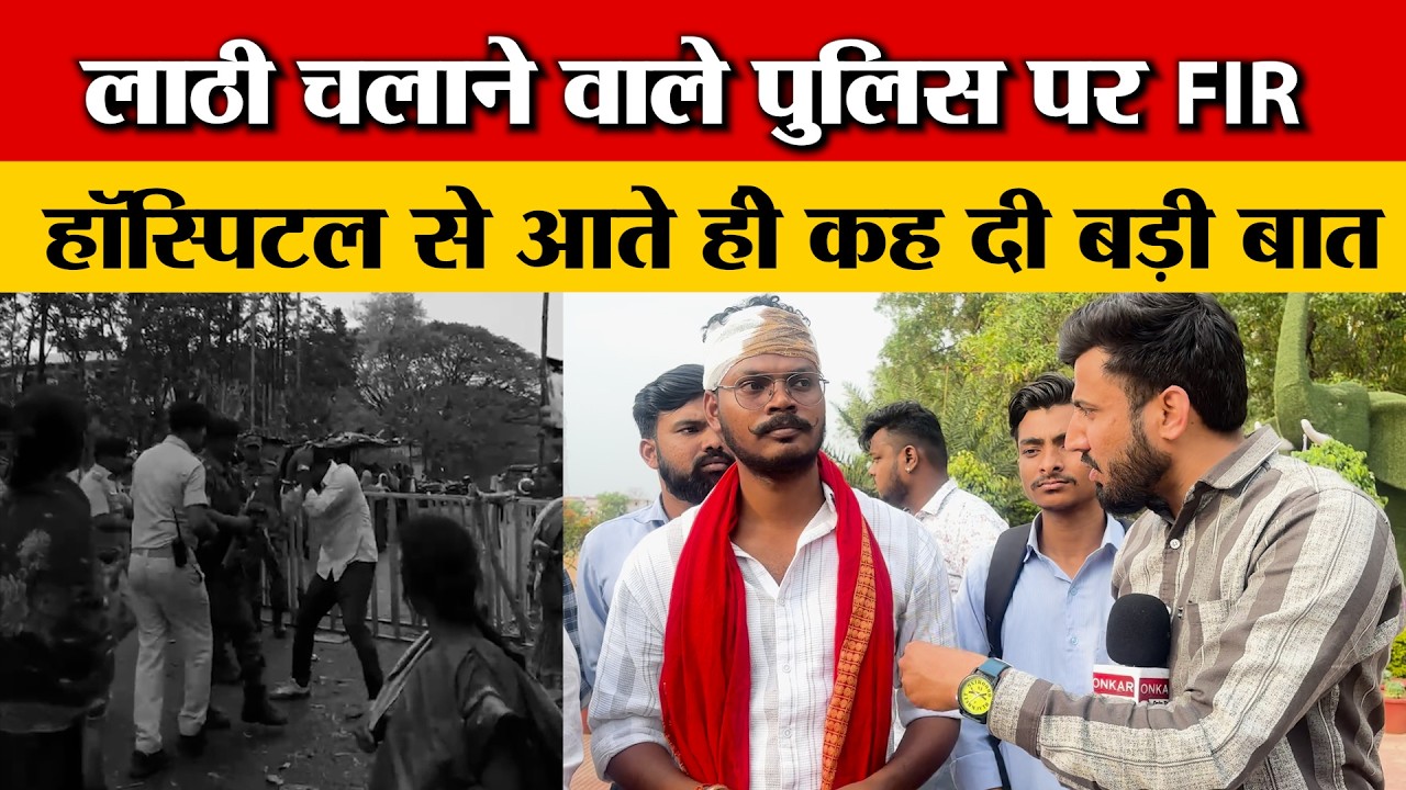 J-TET आंदोलन में कैसे चली थी लाठी, हॉस्पिटल से आने के बाद बबलू महतो ने बताया सबकुछ