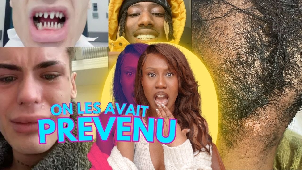 Les dents d'influenceurs, finalement, qu'en est-il ? (Témoignages, formations IG ) #ERL