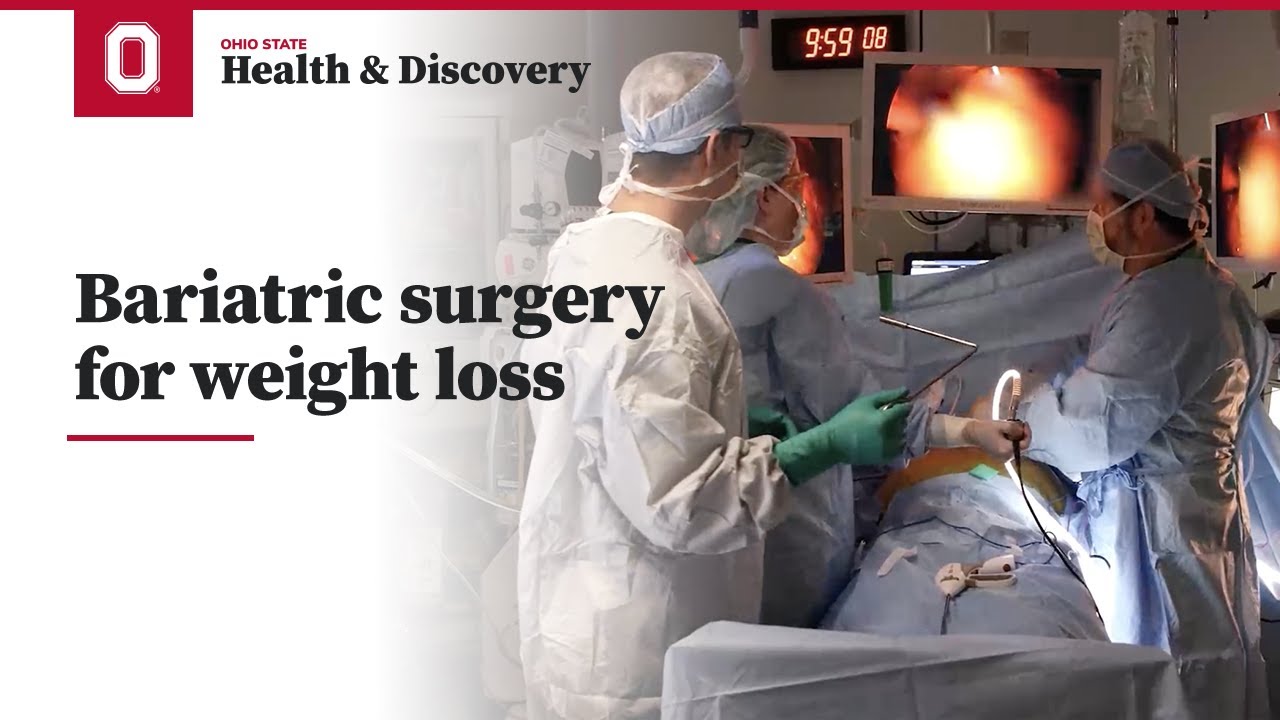 Bariatric surgery for weight loss | Ohio State Medical Center