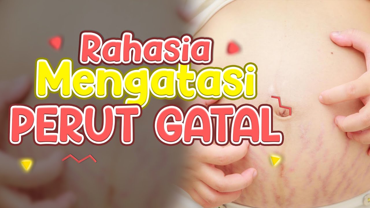 Tips mengatasi perut gatal pada Ibu Hamil || Ayu Harisyah Putri - Medikacare