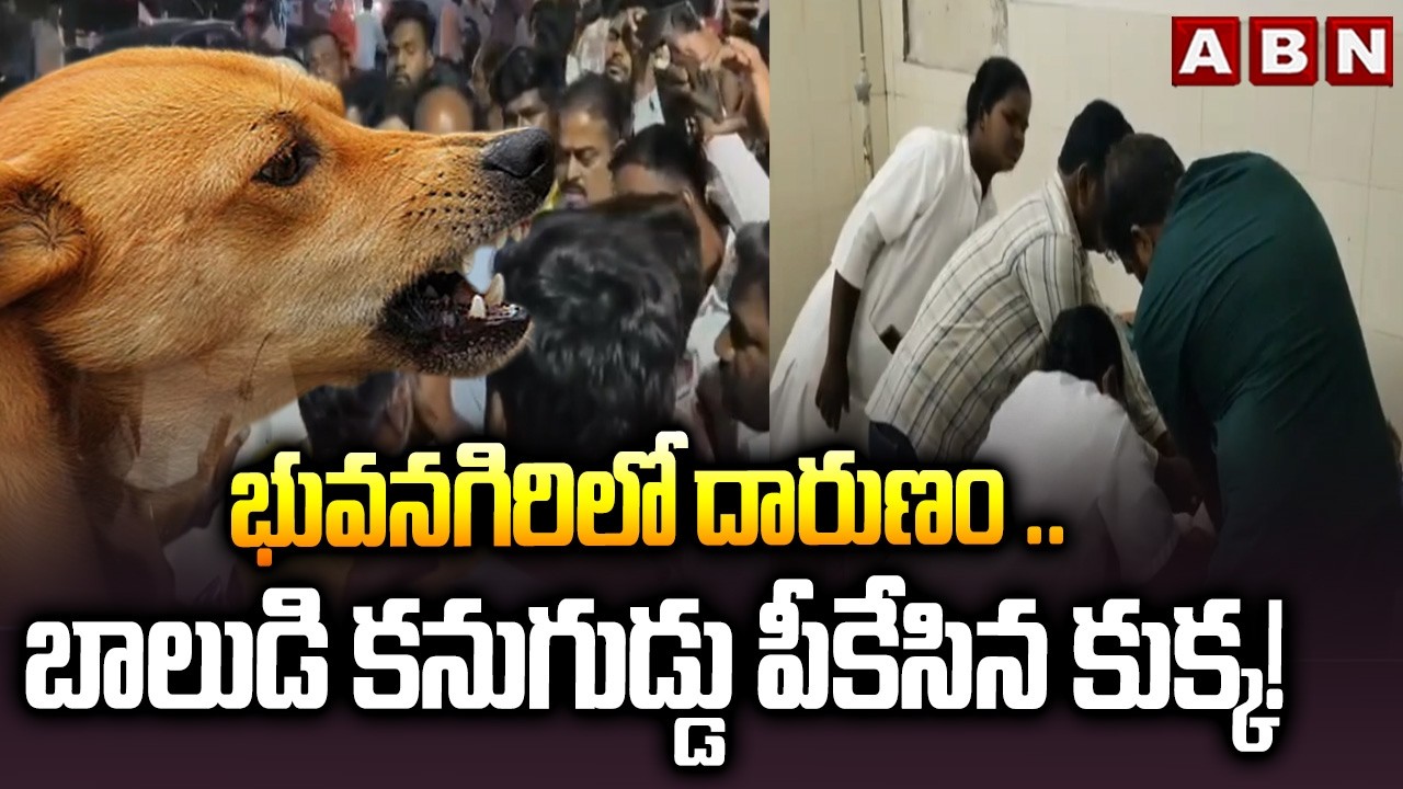 భువనగిరిలో దారుణం .. బాలుడి కనుగుడ్డు పీకేసిన కుక్క! || Stray Dog Att**ack  || Bhuvanagiri || ABN