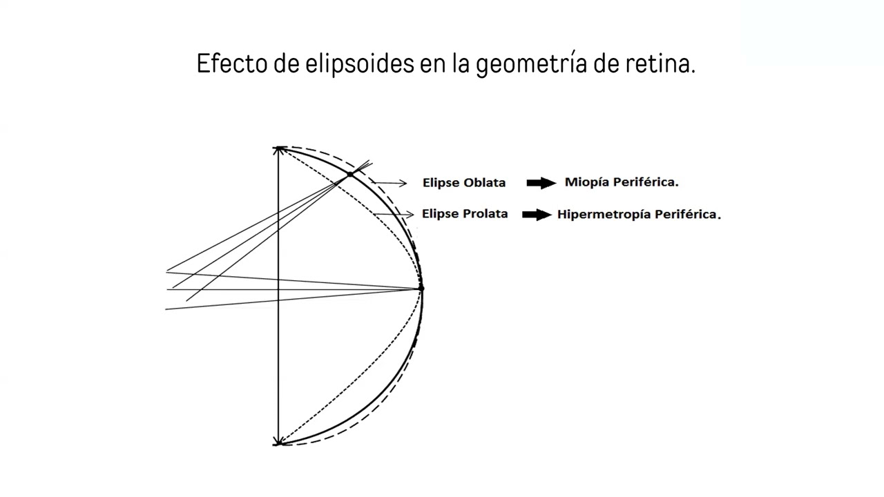 Emetropización y ametropías en niños - Dr Farid Betrán