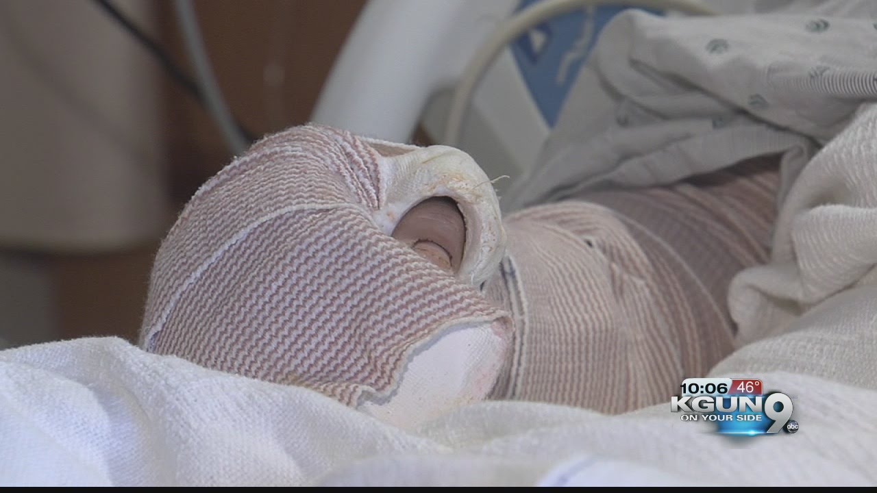 'I have a strong desire to live:' Machete attack victim shares story of survival