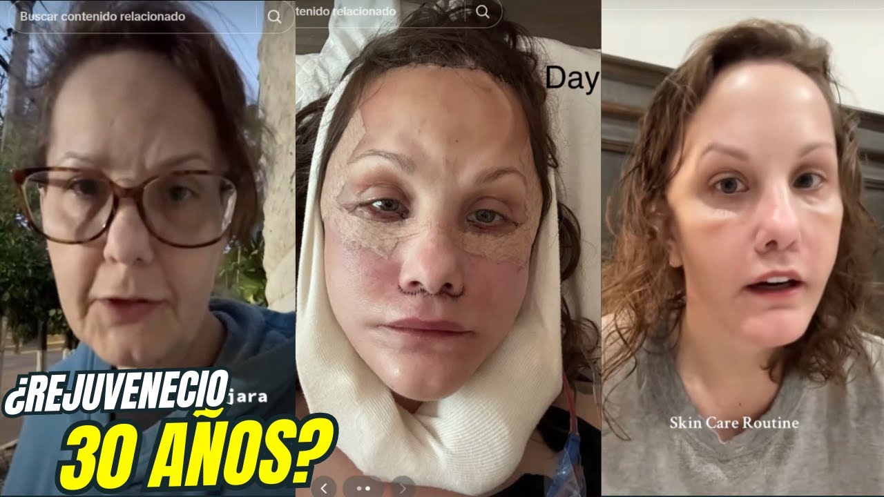 Michelle Wood Rejuveneci&oacute; 30 A&ntilde;os ... &iquest;En una Est&eacute;tica en Guadalajara, M&eacute;xico?