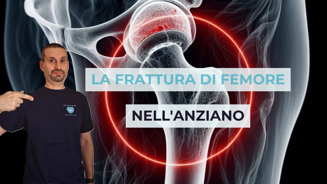 Frattura di femore nell'anziano: conseguenze, percorso e tempi di riabilitazione