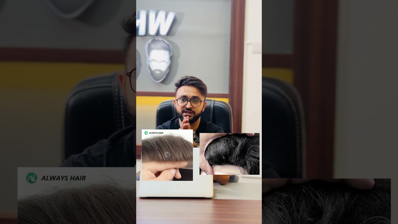 Top 2 Worst Hair Patches in India - Isse Ganda Hair Patch Nahi Ho Şakta!