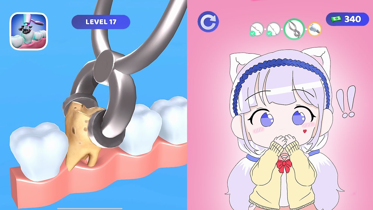[TeethDoc] 어? 아픈 이는 거기가 아닌데요?!