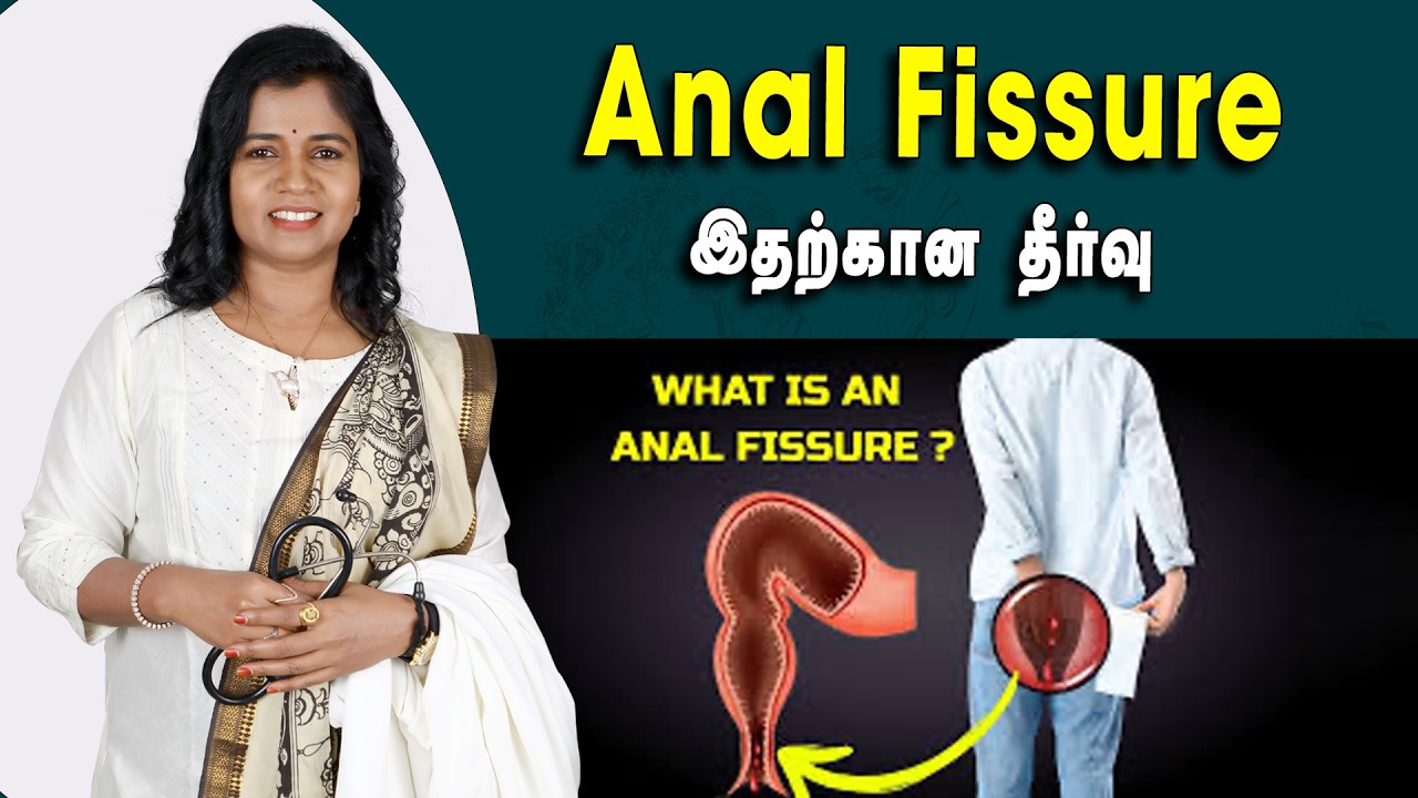 #analfissuretreatment  | Anal Fissure காரணங்கள், அறிகுறிகள் மற்றும் சிகிச்சை முறை | Dr.B.YogaVidhya