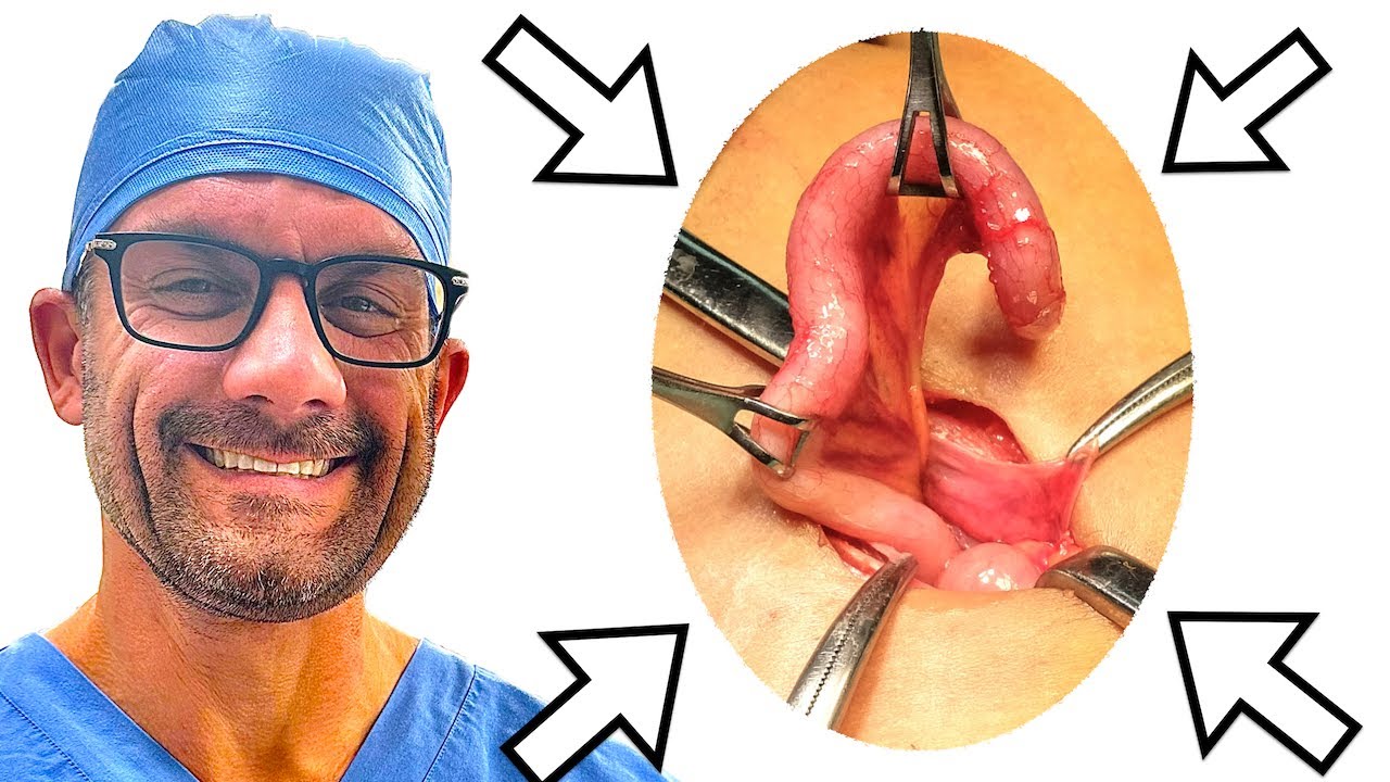 The Mysterious Function and Benefit of the Appendix