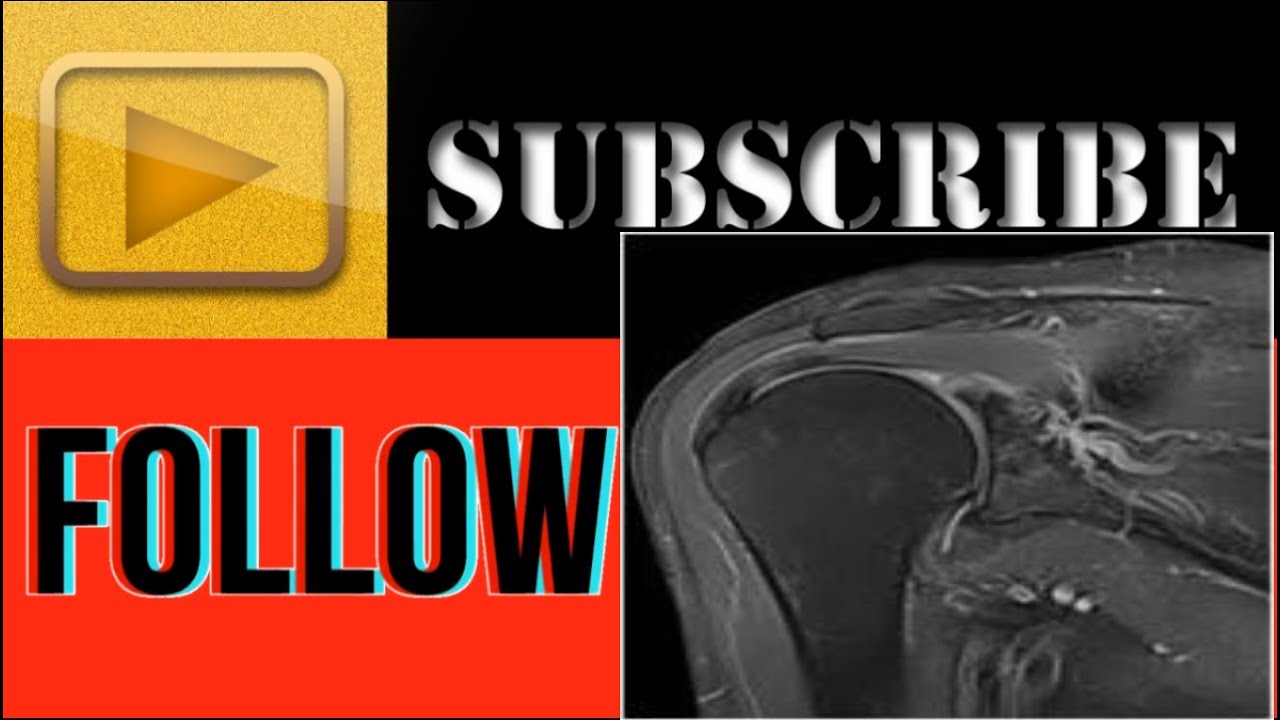 MRI Hitachi 1.5 Tesla Echelon: Actual Planning shoulder plain