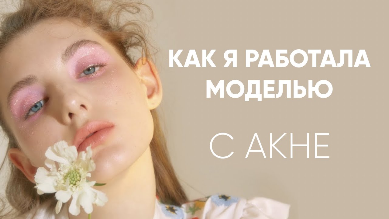 Как я работала моделью с акне? | Про модельные контракты, комплексы, кастинги, съёмки, реакцию людей