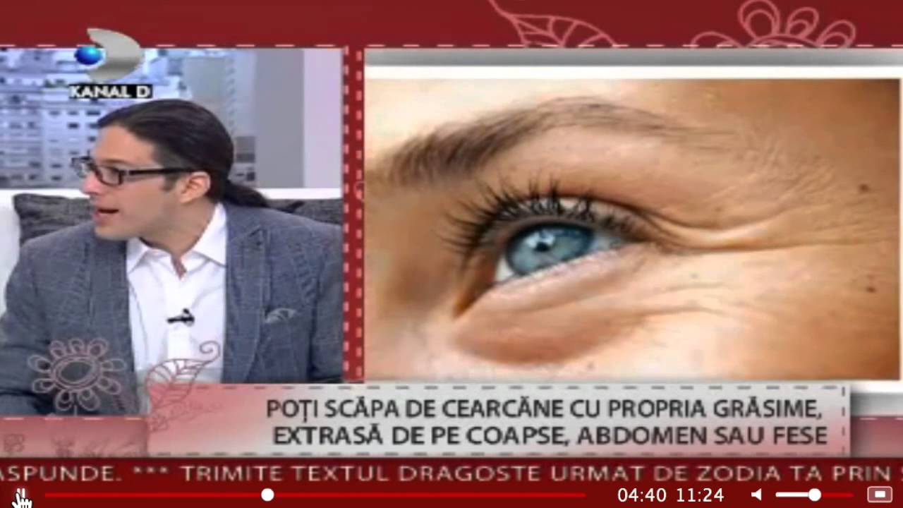 Totul despre tratamentul cearcanelor la emisiunea 