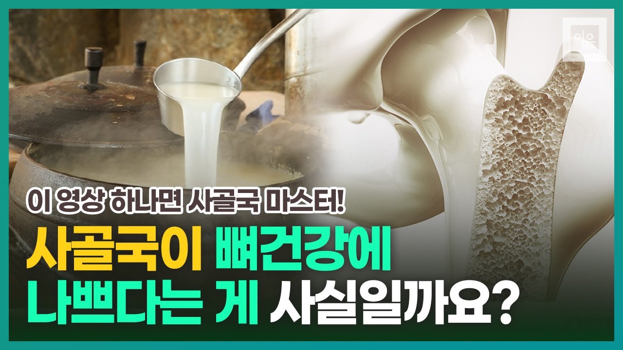 사골국이 정말 뼈 건강(골다공증)에 나쁜지 정확히 알려드립니다