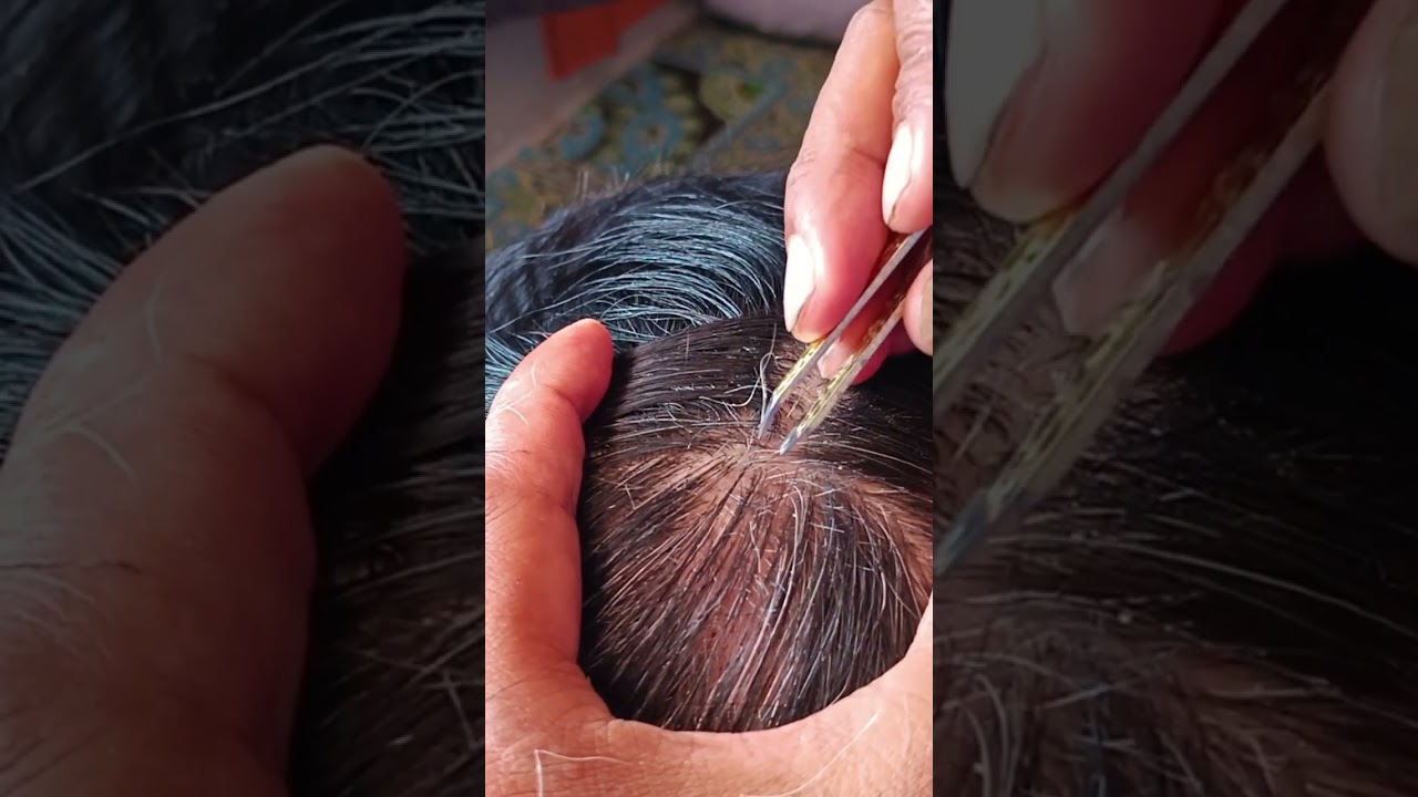 Most satisfying white hair removal#33#soothingrelaxationrelaxing #satisfying #musicbackground