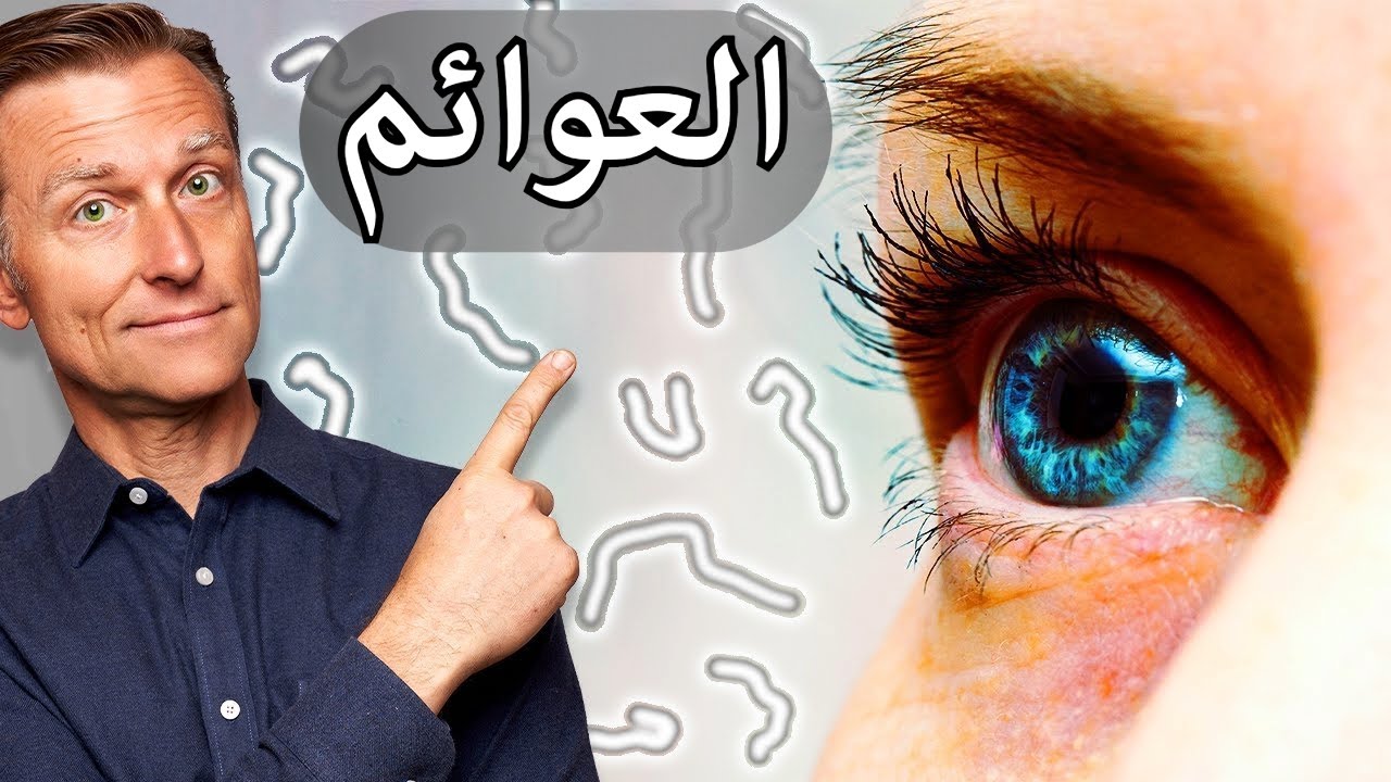 لماذا تحدث عوائم العينين وكيف نتخلص منها وماهو الغذاء الأول للعين