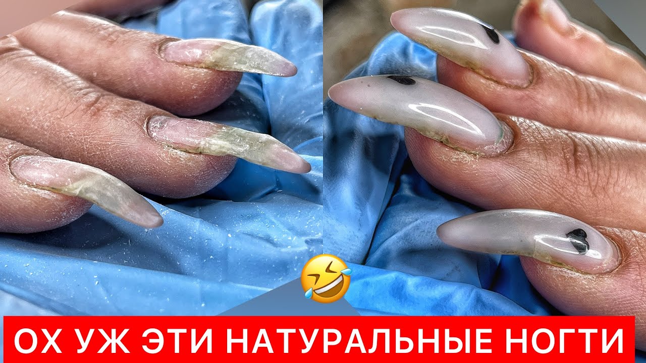 ТРЕШ КОРРЕКЦИЯ КЛЮЮЩИХ НОГТЕЙ🤬 ФРАНЦУЗКИЙ МАНИКЮР