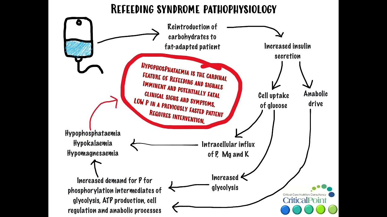 Refeeding Syndrome
