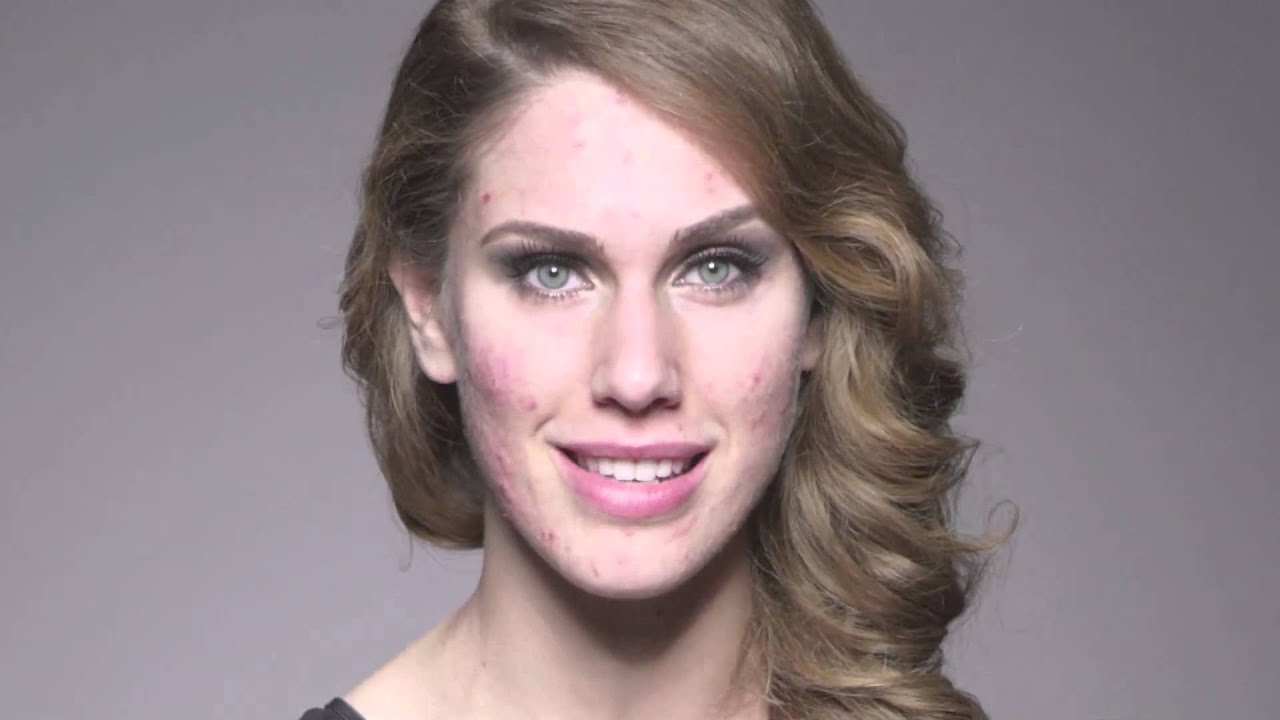 HSN | Dermablend Camo Confessions- Cassandra on beating the bullies