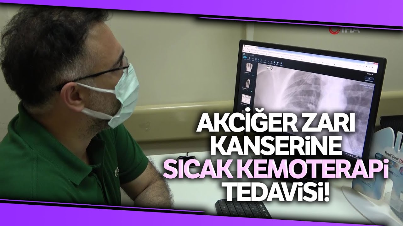 Akciğer Zarı Kanserine Sıcak Kemoterapi Tedavisi