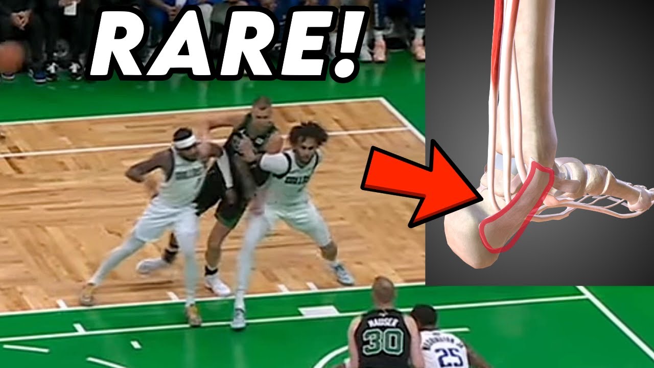 Porzingis Has Injury Nobody&rsquo;s Heard of and Luka Doncic Needs Pain Shots - Doctor Explains