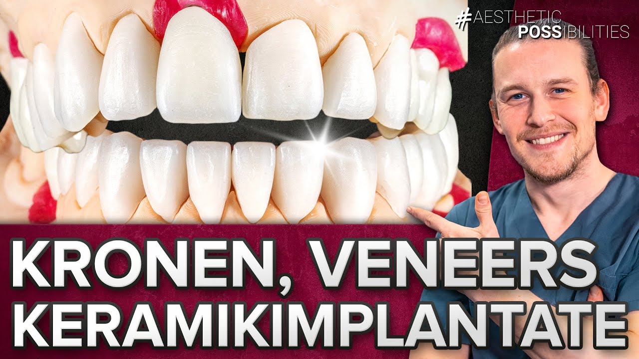 Keramikzahnimplantate + Veneers und Kronen versorgt! Ober- und Unterkiefer Smile Makeover 🦷