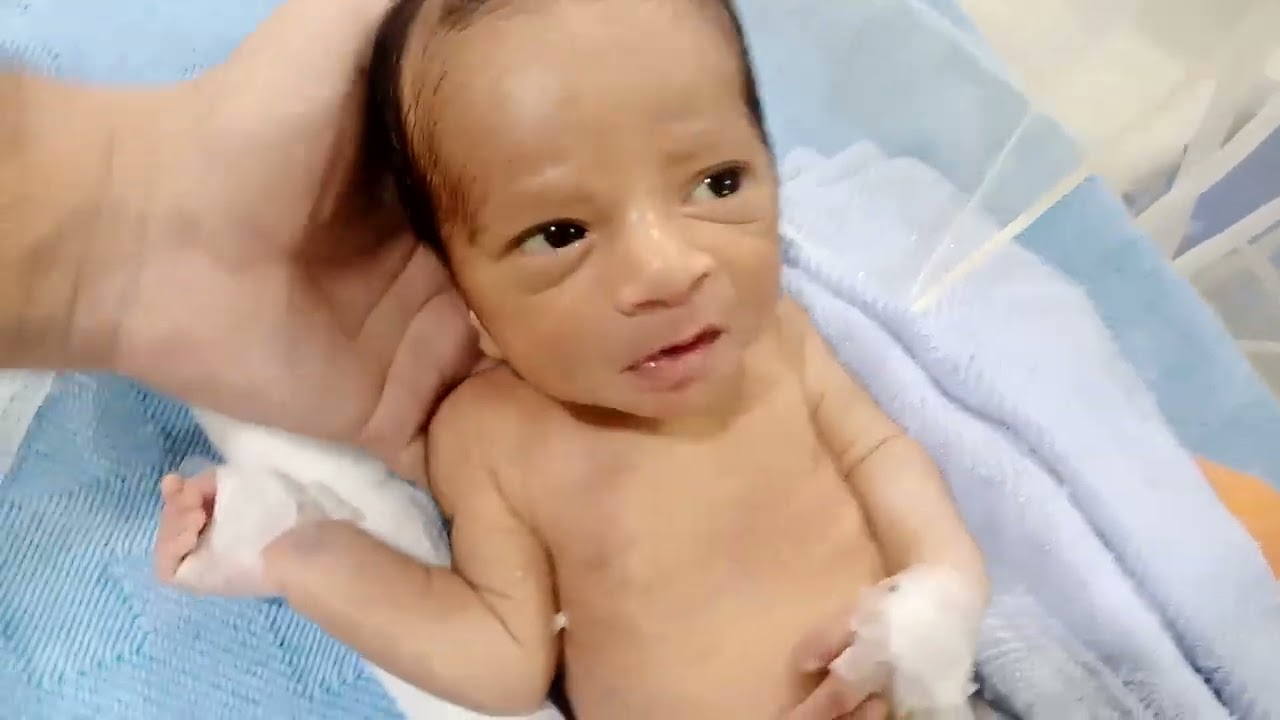 Cute NICU Baby Recovers from Grunting RDS start feeding #neonatalcare #nicubaby 