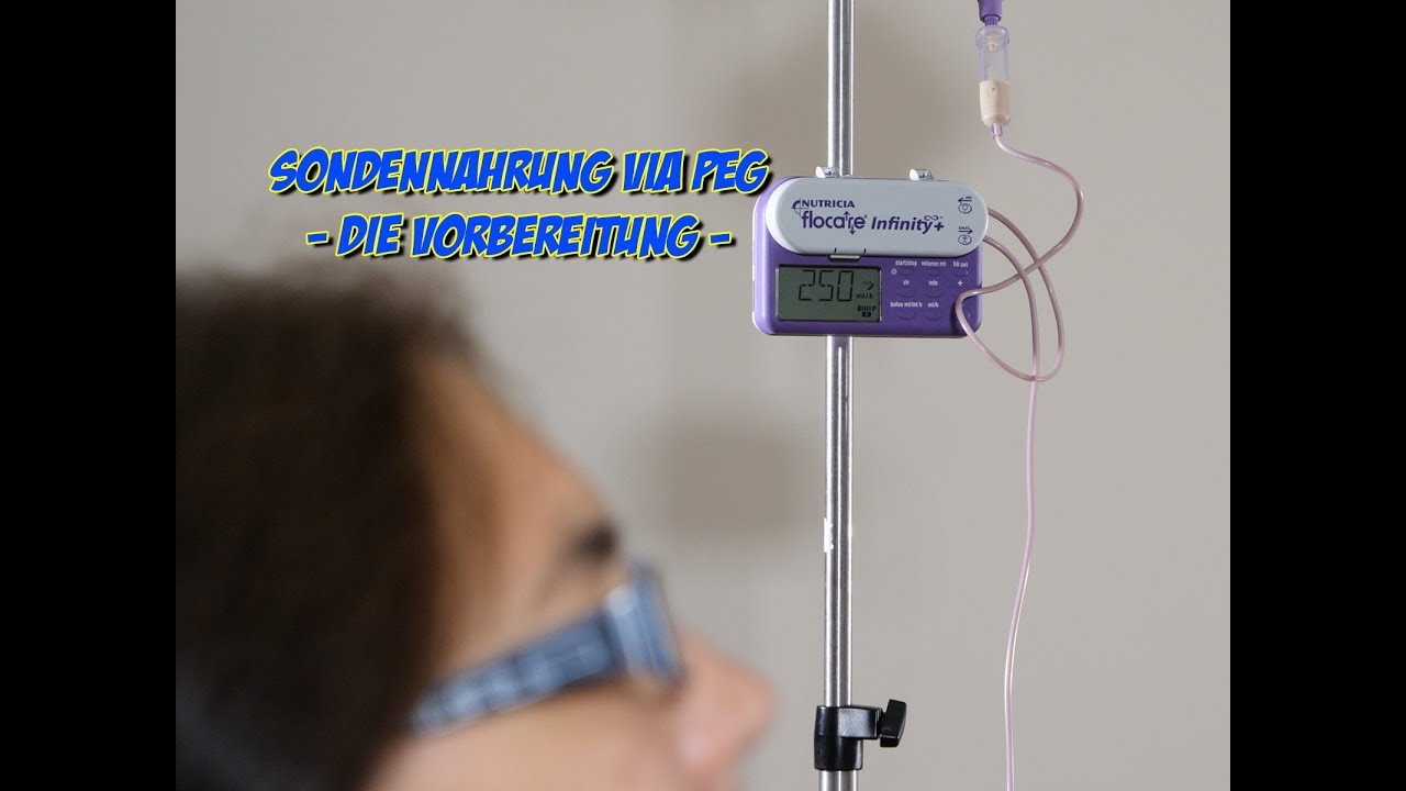 Sondennahrung via PEG - die Vorbereitung