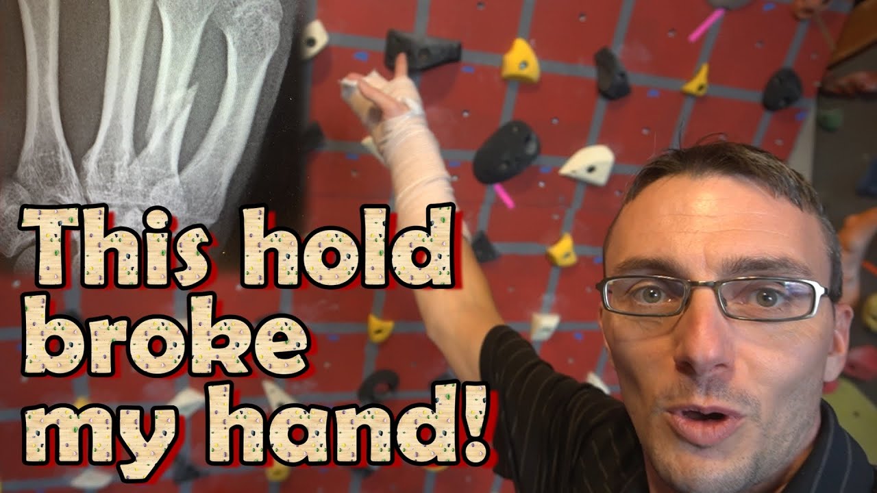 Climbing Injury Recovery & Getting My Revenge - Part 1