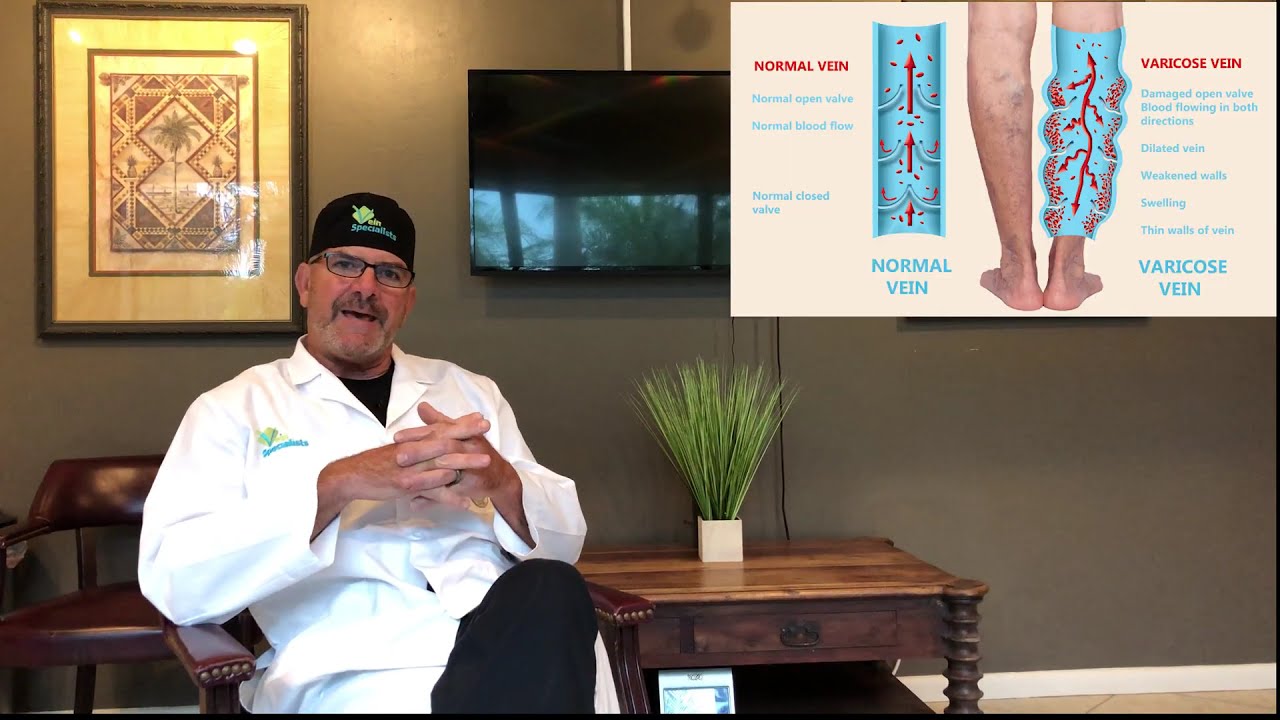 What is vein disease?