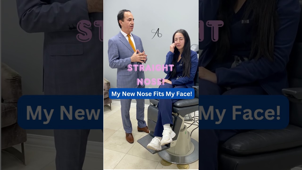 An Amazing Long Term Results! | Fixing  Fractured & Crooked Nose! | Ethnic Rhinoplasty! | Cut Nose!