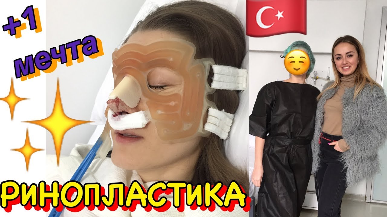 РИНОПЛАСТИКА в Турции🇹🇷 Показываю ВСЕ- ВСЕ